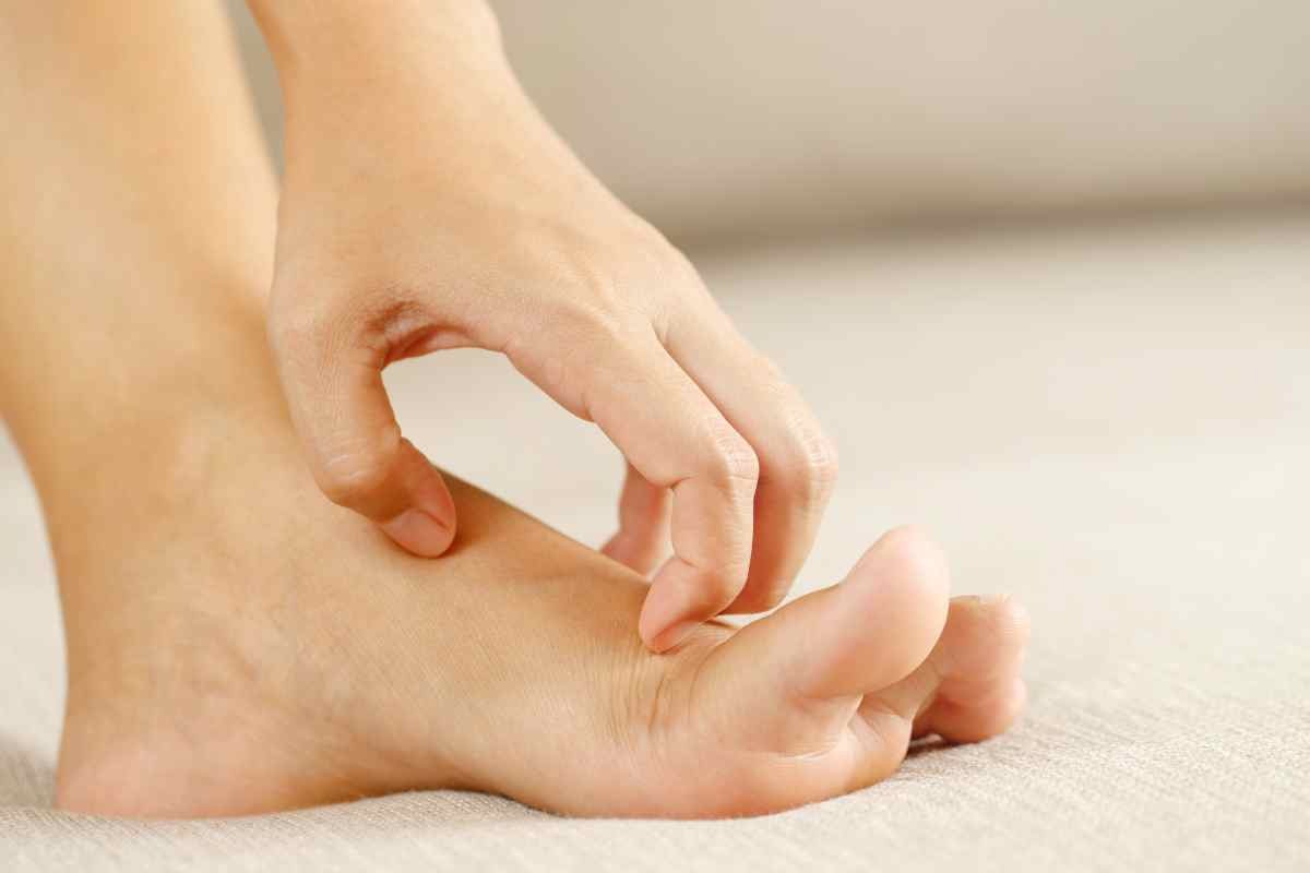 Malattie che causano prurito dei piedi